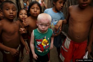 Kipigaliler Harris, 5, who is part of the albino or "Children of the Moon" group in the Guna Yala indigenous community, stands with friends and relatives outside his house as they look at the camera on Ogobsugun Island in the Guna Yala region Panama April 28, 2015. REUTERS/Carlos Jasso